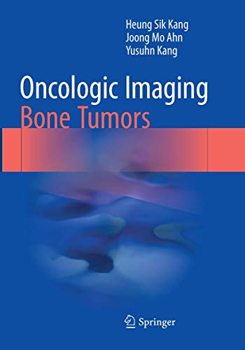 Oncologic Imaging: Bone Tumors Oncologic Imaging: Bone Tumors