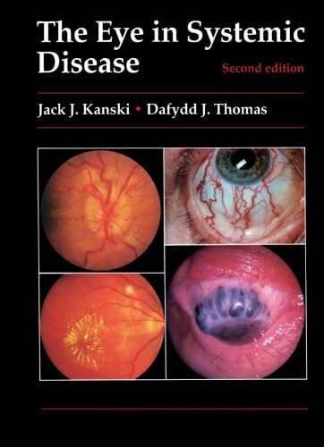 The Eye in Systemic Disease: Second Edition von Butterworth-Heinemann