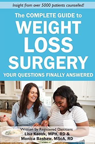 The Complete Guide to Weight Loss Surgery: Your questions finally answered von CREATESPACE