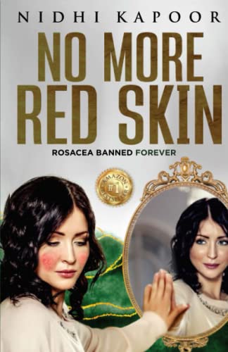 No More Red Skin: Rosacea Banned Forever