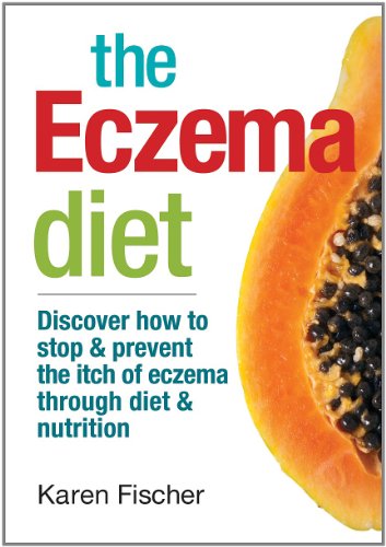 The Eczema Diet: Discover How to Stop and Prevent the Itch of Eczema Through Diet and Nutrition: Discover How to Stop & Prevent the Itch of Eczema Through Diet & Nutrition von Robert Rose