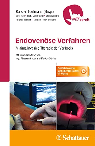 Endovenöse Verfahren: Minimalinvasive Therapie der Varikosis - griffbereit - Zusätzlich online, auch über QR-Codes: OP-Videos