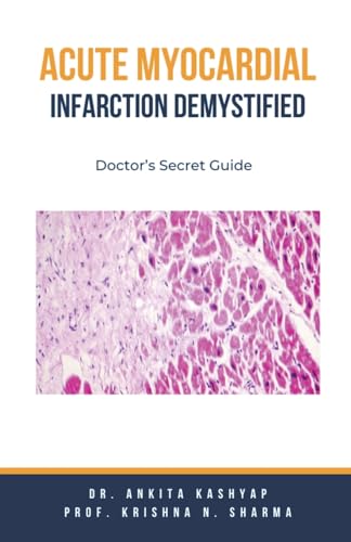 Acute Myocardial Infarction Demystified: Doctor's Secret Guide von Virtued Press