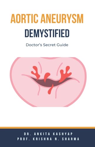 Aortic Aneurysm Demystified: Doctor's Secret Guide von Virtued Press