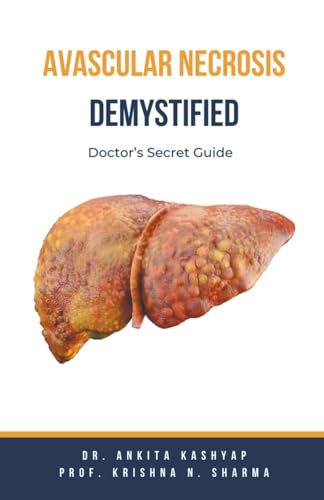 Avascular Necrosis Demystified: Doctor's Secret Guide von Virtued Press