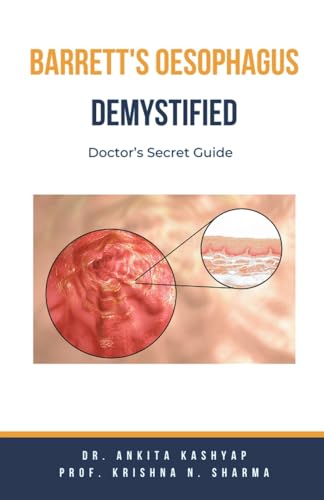 Barretts Oesophagus Demystified: Doctor's Secret Guide von Virtued Press