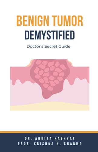 Benign Tumor Demystified: Doctor's Secret Guide von Virtued Press