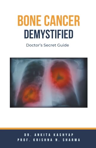 Bone Cancer Demystified: Doctor's Secret Guide von Virtued Press