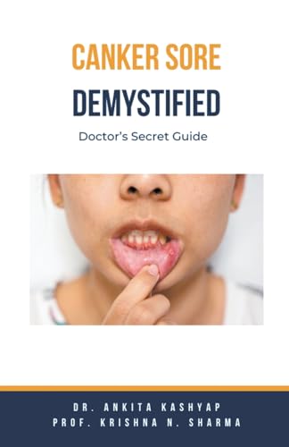 Canker Sore Demystified: Doctor's Secret Guide von Virtued Press