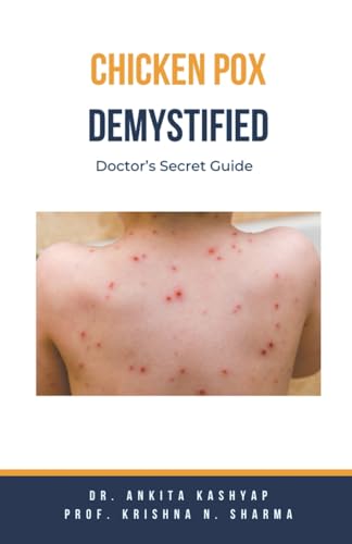 Chickenpox Demystified: Doctor's Secret Guide von Virtued Press
