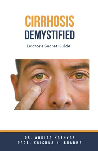 Cirrhosis Demystified: Doctor's Secret Guide von Virtued Press