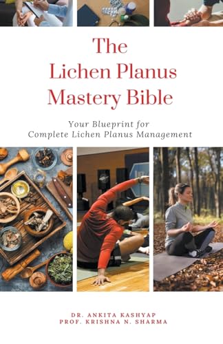 The Lichen Planus Mastery Bible: Your Blueprint for Complete Lichen Planus Management von Virtued Press