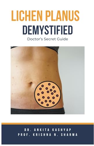 Lichen Planus Demystified Doctors Secret Guide von Virtued Press