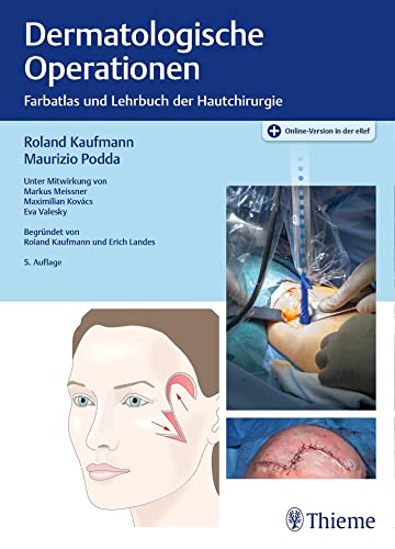 Dermatologische Operationen: Farbatlas und Lehrbuch der Hautchirurgie von Georg Thieme Verlag
