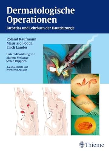 Dermatologische Operationen: Farbatlas und Lehrbuch der Hautchirurgie