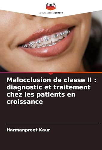 Malocclusion de classe II : diagnostic et traitement chez les patients en croissance von Editions Notre Savoir
