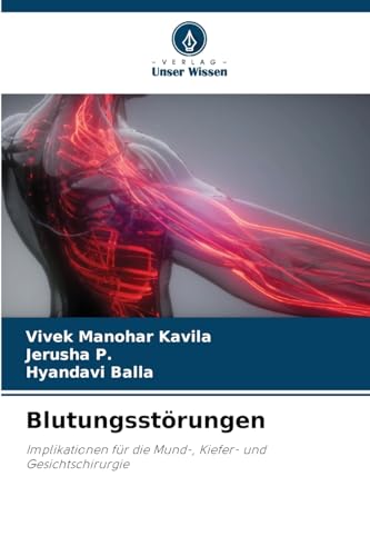 Blutungsstörungen: Implikationen für die Mund-, Kiefer- und Gesichtschirurgie von Verlag Unser Wissen