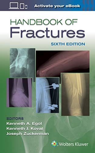 Handbook of Fractures von LWW