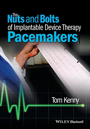 The Nuts and Bolts of Implantable Device Therapy: Pacemakers