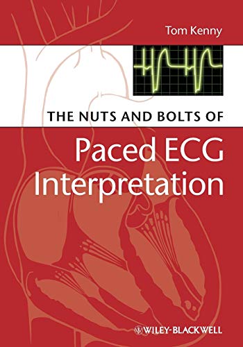 The Nuts and Bolts of Paced ECG Interpretation (Nuts and Bolts Series (Replaced by 5113)) von Wiley