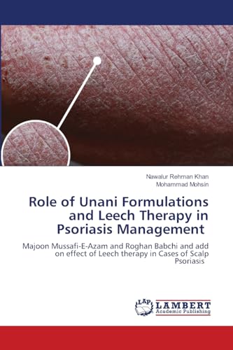 Role of Unani Formulations and Leech Therapy in Psoriasis Management: Majoon Mussafi-E-Azam and Roghan Babchi and add on effect of Leech therapy in ... Leech therapy in Cases of Scalp Psoriasis.DE