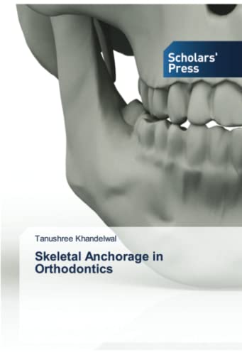 Skeletal Anchorage in Orthodontics: DE