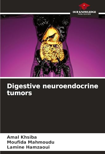 Digestive neuroendocrine tumors: DE von Our Knowledge Publishing