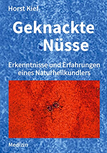 Geknackte Nüsse: Erkenntnisse und Erfahrungen eines Naturheilkundlers von Books on Demand