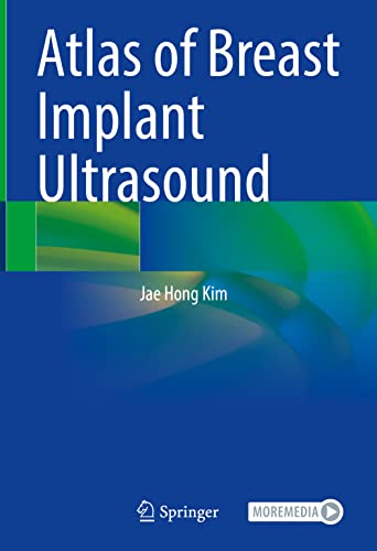 Atlas of Breast Implant Ultrasound von Springer
