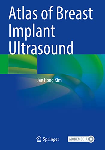 Atlas of Breast Implant Ultrasound von Springer