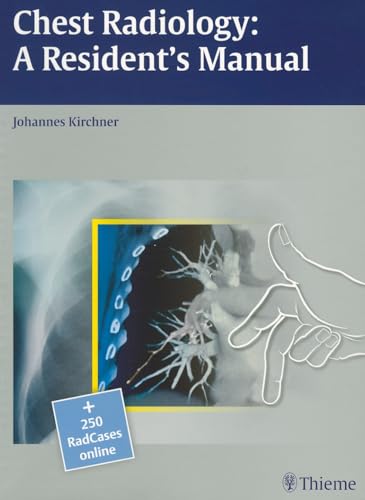 Chest Radiology: A Resident's Manual