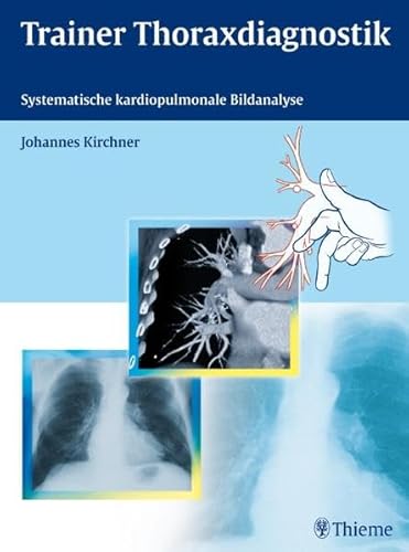 Trainer Thoraxdiagnostik: Systematische kardiopulmonale Bildanalyse