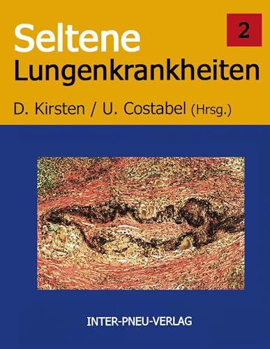 Seltene Lungenkrankheiten. Band 2 von Books on Demand GmbH