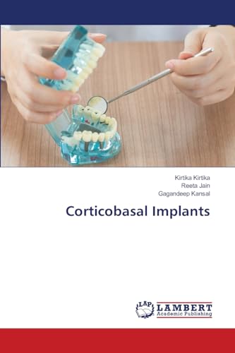Corticobasal Implants: DE von LAP LAMBERT Academic Publishing