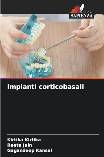 Impianti corticobasali: DE von Edizioni Sapienza