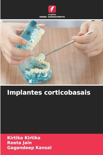 Implantes corticobasais: DE von Edições Nosso Conhecimento