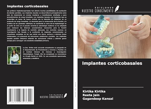 Implantes corticobasales von Ediciones Nuestro Conocimiento