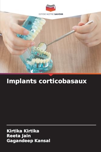Implants corticobasaux: DE von Editions Notre Savoir