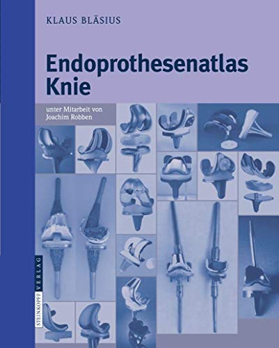 Endoprothesenatlas Knie