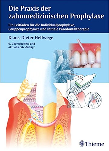 Die Praxis der zahnmedizinischen Prophylaxe: Ein Leitfaden f. d. Individual-, Gruppenprophylaxe u. initiale Parodontaltherapi (ZMK Praxis) von Thieme