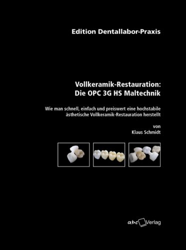 Vollkeramik-Restauration: Die OPC 3G HS Maltechnik: Wie man schnell, einfach und preiswert eine hochstabile ästhetische Vollkeramik-Restauration herstellt