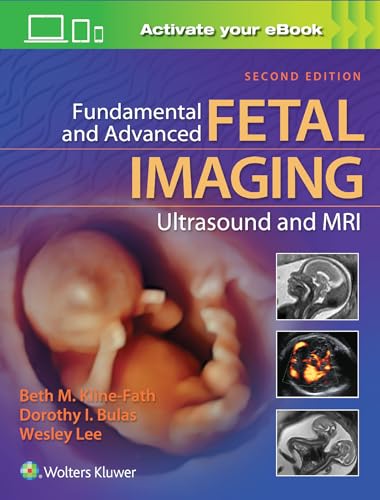 Fundamental and Advanced Fetal Imaging Ultrasound and MRI von LWW