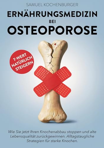 Ernährungsmedizin bei Osteoporose: Von gesunder zu knochenstarker Ernährung - Machen Sie die Ernährung zu Ihrer stärksten Waffe gegen Osteoporose. Langfristige Ernährungsstrategien für starke Knochen. von Lucid Page Media