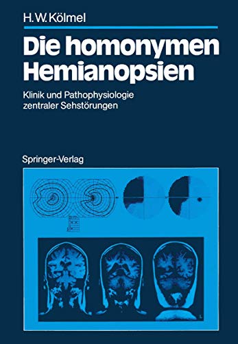 Die homonymen Hemianopsien: Klinik und Pathophysiologie zentraler Sehstörungen von Springer