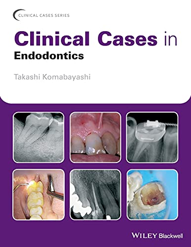 Clinical Cases in Endodontics (Clinical Cases (Dentistry)) von Wiley