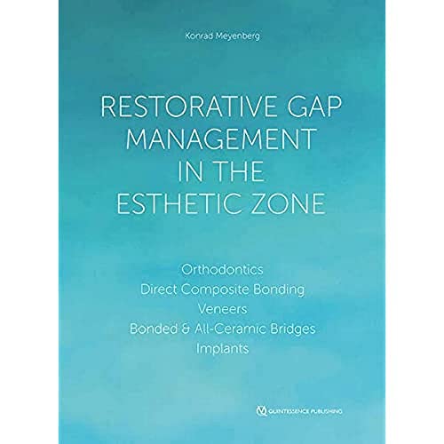 Restorative Gap Management in the Esthetic Zone: Orthodontics | Direct Composite Bonding | Veneers | Bonded & All-Ceramic Bridges Implants