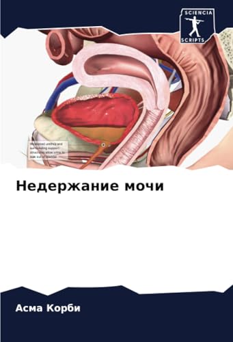 Недержание мочи: DE