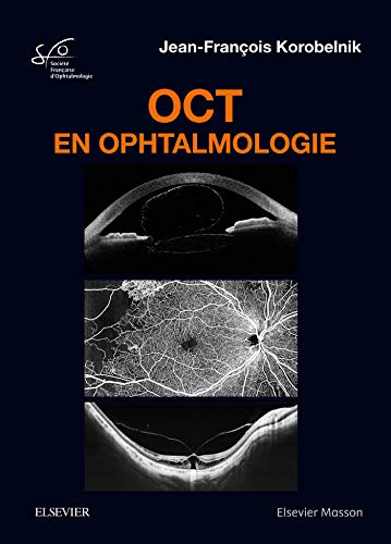 OCT en ophtalmologie OCT en ophtalmologie
