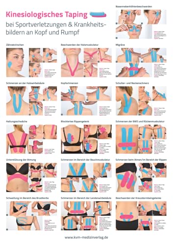 Poster Kinesiologisches Taping (3 Poster im Set): bei Sportverletzungen und Krankheitsbildern von KVM-Der Medizinverlag