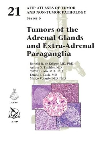 Tumors of the Adrenal Glands and Extra-Adrenal Paraganglia (AFIP Atlas of Tumor and Non-Tumor Pathology, Series 5, Band 21) von American Registry of Pathology